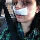 After surgery