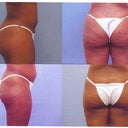 top is the after shot and the bottom is the before
