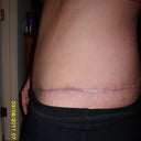 13 weeks....pants actually cover scar.