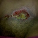 My hole pray for me I'm scared