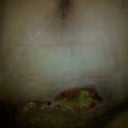 Taken 9-5-10 I wish it would heal