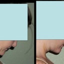 before and after (1/12/2012)