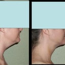 before and after (1/12/2012)