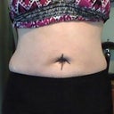 Bathing Suit After, Front (2 Weeks)