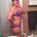 3 weeks Post OP
