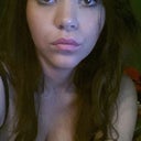 1 1/2 years post op. Nose still changing with every season. Seems like swelling still going down.