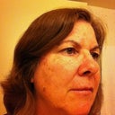 Day 15 right side