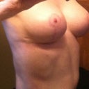 AFTER- 3 month mark (13 weeks)
