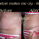 26 days ~ before and after