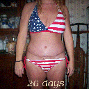 26 days ~ incision/scar