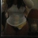 She filled in my hips perfectly  3 days PO