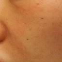 Pink patches near nose