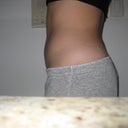 11 days after side