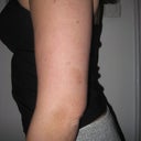 11 days after arm