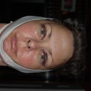 1 day post-op