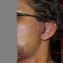 7 - 8 days after