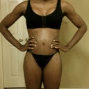 PO 8: bikini covers scars yayy. Post up belly measurement is 1 inch lower than preop...still some swelling.