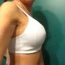 Side view with the new bra starting to drop a bit