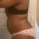 this is what i look like currently. This is in the morning before eating anything. So i realized at one point this was NOT just bloating...