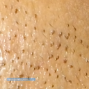 This picture is 175% zoomed in just to see how the spot looks in close-up.