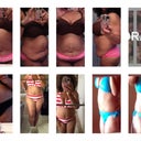 I added this for an easier before and after comparison.  The afters are from day 6 post op.