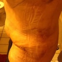 PO day two, very swollen in the belly. But results are looking good.