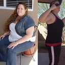 Before weight loss and after losing 100 pounds. Both are prior to surgery.