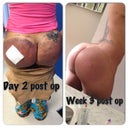 WHAT A DIFF EH!??... From day 2 to day 22... Crazy... :-)