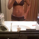 Before mini tummy tuck