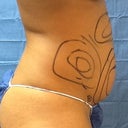 before side