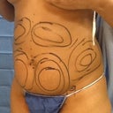 before angle