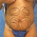 before front