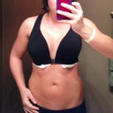 Day 1 post op. 36D bra.