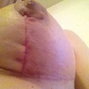 Day 10 Underside