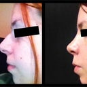 before/2weeks