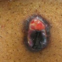 My belly button is not looking good.