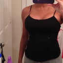Post op week one in cami