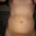 Taken a few days after