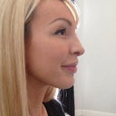 2 week post op profile, getting a nice slight slope, still a bit swollen tip and columella. philtrum swelling went down, no more "rubber ducky" lips profile lol