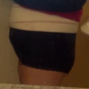 9 days post opp