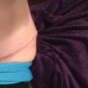 dog ear left, before revision