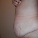 my left side before
