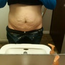 night and day difference with clothes off..Can't get rid of the extra fat and extra skin and muscle separation