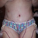 Day 1 post op