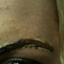 This is about 3 hours after having the Rejuvi applied.