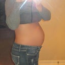 PRE OP - Big fat belly after 2 kiddos and no stretch marks, thank goodness!
