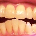 5-9-2012 Tray 5/24