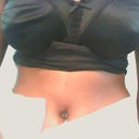 belly button - 1 week post op