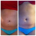 Before and 10 days after front