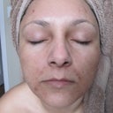 march 10-2 weeks after